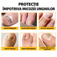 Wellife Plasturi pentru micoza unghiilor, 32 buc.