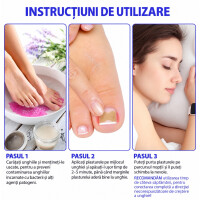 Wellife Plasturi pentru unghii încarnate, 100 buc