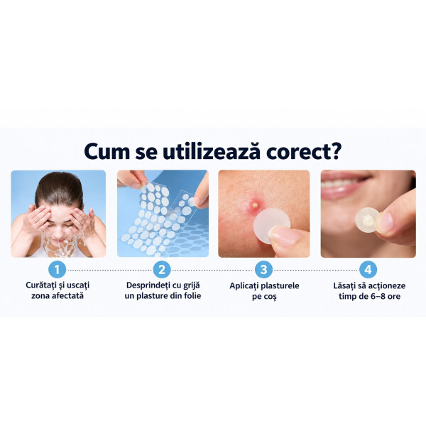 Wellife Plasturi transparenți pentru acnee, 180 buc
