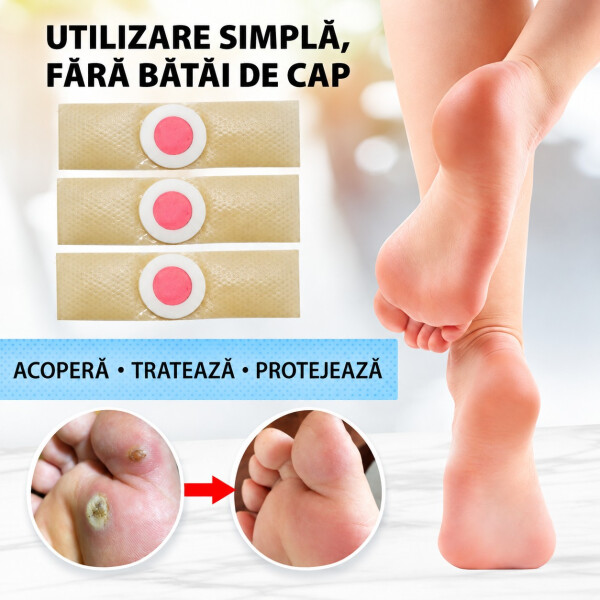Wellife Plasturi pentru negi 24 buc