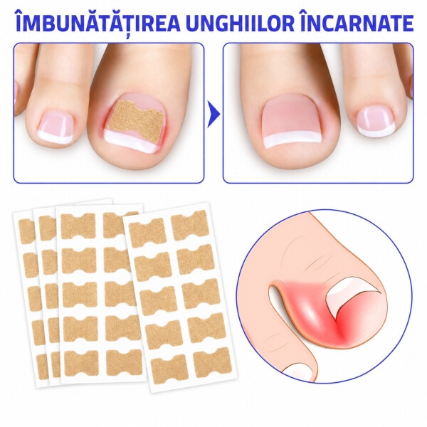 Wellife Plasturi pentru unghii încarnate, 100 buc