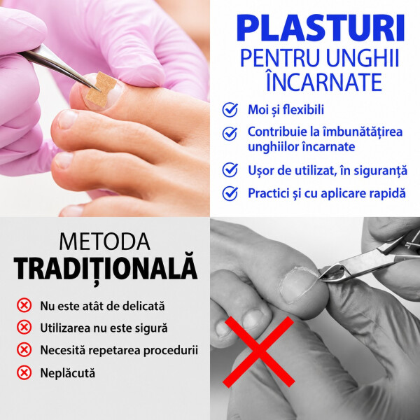 Wellife Plasturi pentru unghii încarnate, 100 buc